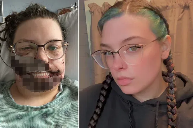 Peoria: 25-Year-Old Woman Severely Injured by Family Dog After Seizure